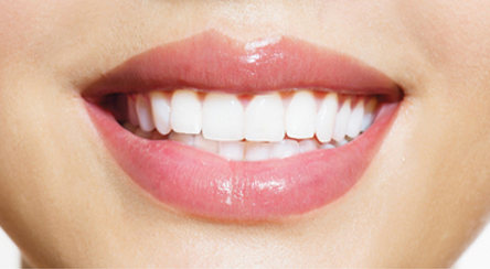 White Teeth on smiling woman